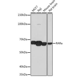 Western Blot - Anti-Retinoic Acid Receptor alpha Antibody [ARC0030] (A307040) - Antibodies.com