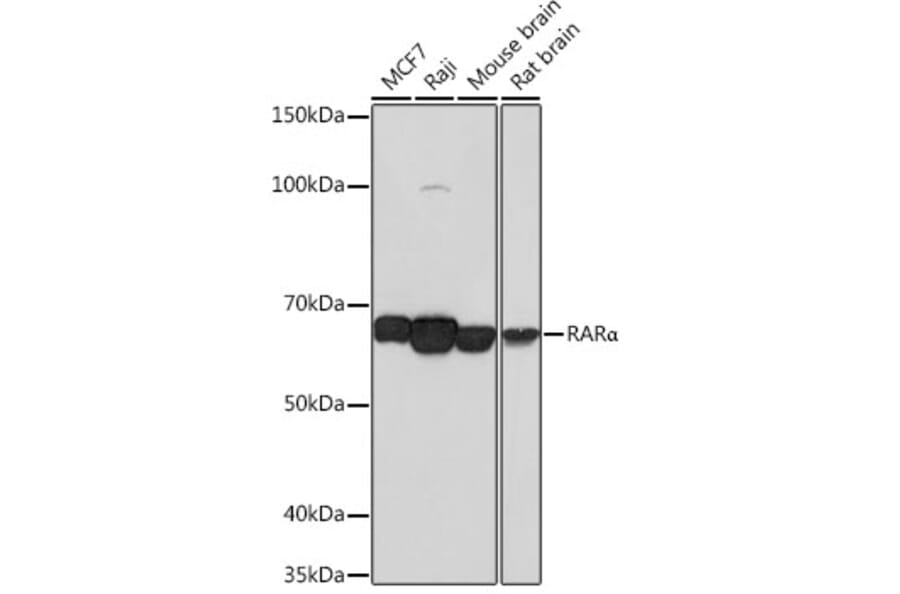Western Blot - Anti-Retinoic Acid Receptor alpha Antibody [ARC0030] (A307040) - Antibodies.com