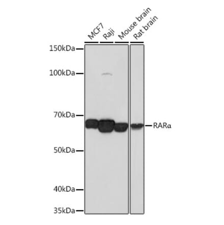 Western Blot - Anti-Retinoic Acid Receptor alpha Antibody [ARC0030] (A307040) - Antibodies.com