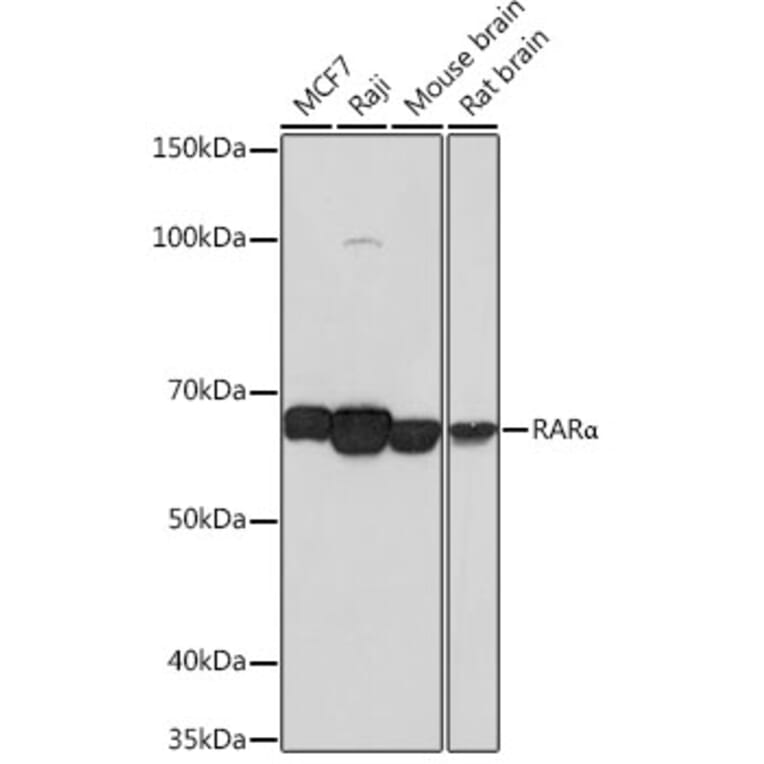 Western Blot - Anti-Retinoic Acid Receptor alpha Antibody [ARC0030] (A307040) - Antibodies.com