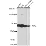 Western Blot - Anti-Retinoic Acid Receptor alpha Antibody [ARC0030] (A307040) - Antibodies.com