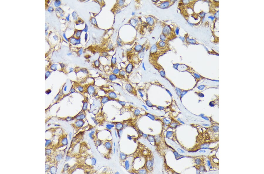 Immunohistochemistry - Anti-Retinoic Acid Receptor alpha Antibody [ARC0030] (A307040) - Antibodies.com
