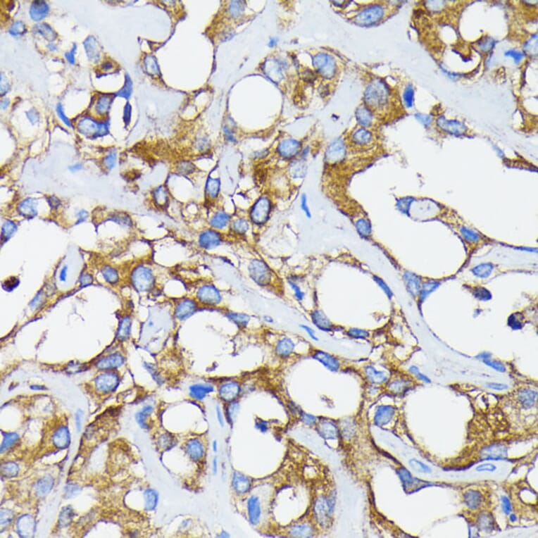 Immunohistochemistry - Anti-Retinoic Acid Receptor alpha Antibody [ARC0030] (A307040) - Antibodies.com