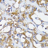 Immunohistochemistry - Anti-Retinoic Acid Receptor alpha Antibody [ARC0030] (A307040) - Antibodies.com