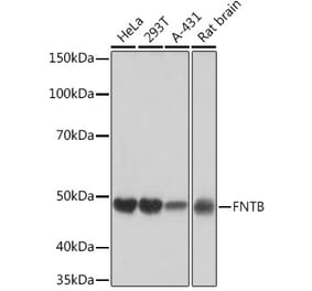 Western Blot - Anti-FNTB Antibody [ARC1923] (A307043) - Antibodies.com