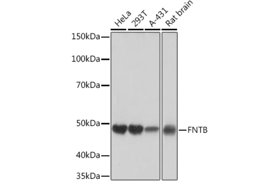 Western Blot - Anti-FNTB Antibody [ARC1923] (A307043) - Antibodies.com