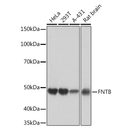 Western Blot - Anti-FNTB Antibody [ARC1923] (A307043) - Antibodies.com