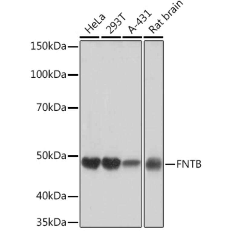 Western Blot - Anti-FNTB Antibody [ARC1923] (A307043) - Antibodies.com