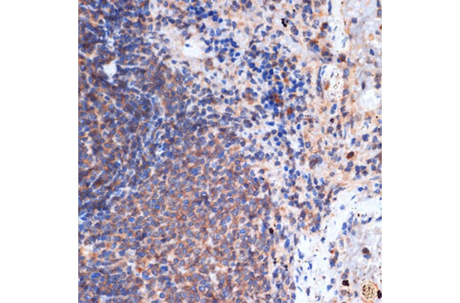 Immunohistochemistry - Anti-FNTB Antibody [ARC1923] (A307043) - Antibodies.com