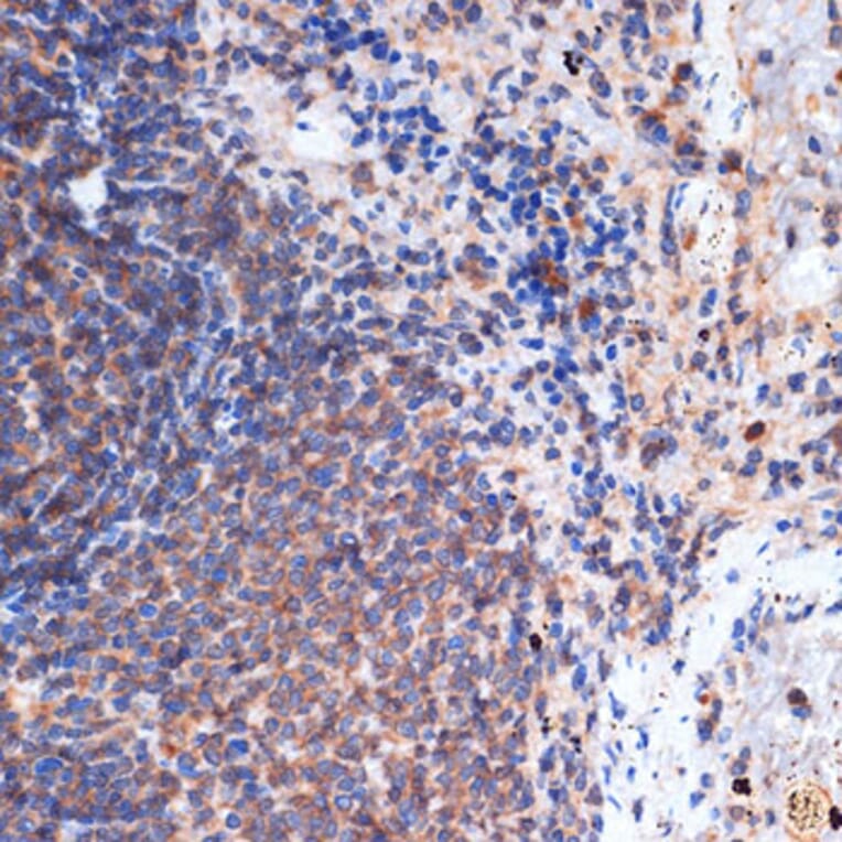 Immunohistochemistry - Anti-FNTB Antibody [ARC1923] (A307043) - Antibodies.com