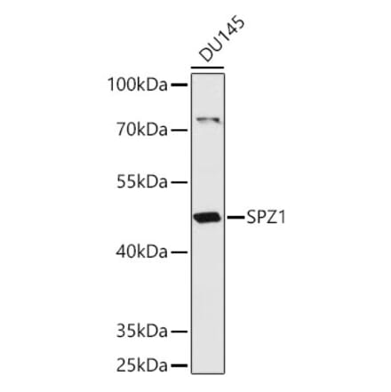 Western Blot - Anti-SPZ1 Antibody (A307044) - Antibodies.com