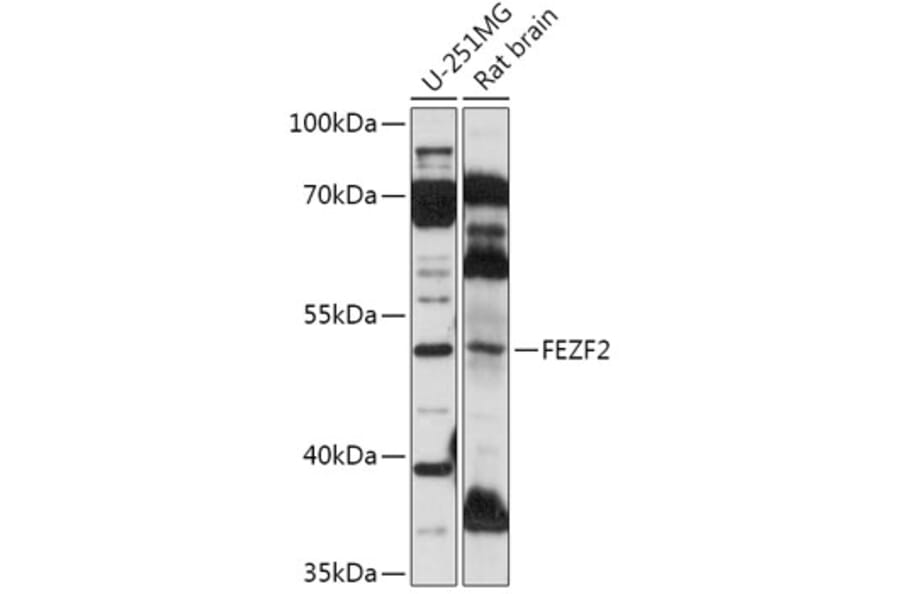 Western Blot - Anti-ZNF312/FEZF2 Antibody (A307045) - Antibodies.com