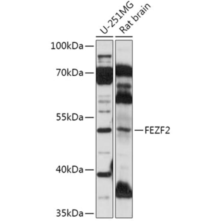 Western Blot - Anti-ZNF312/FEZF2 Antibody (A307045) - Antibodies.com