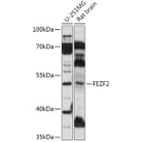 Western Blot - Anti-ZNF312/FEZF2 Antibody (A307045) - Antibodies.com