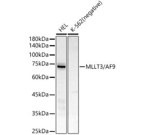 Western Blot - Anti-AF9 Antibody [ARC51958] (A307046) - Antibodies.com