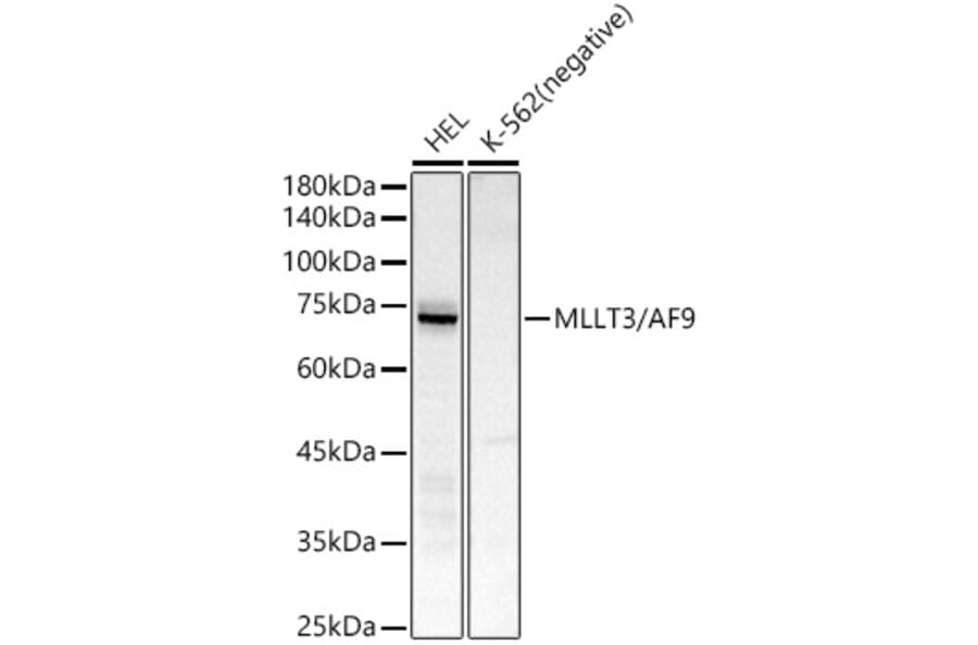 Western Blot - Anti-AF9 Antibody [ARC51958] (A307046) - Antibodies.com