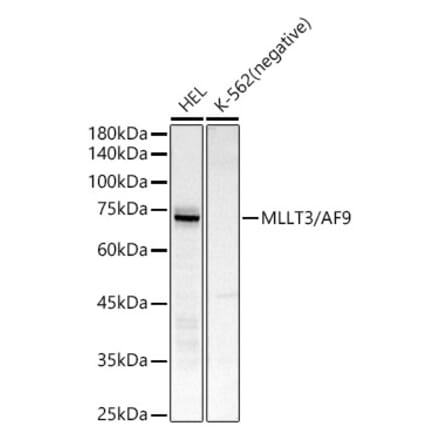 Western Blot - Anti-AF9 Antibody [ARC51958] (A307046) - Antibodies.com