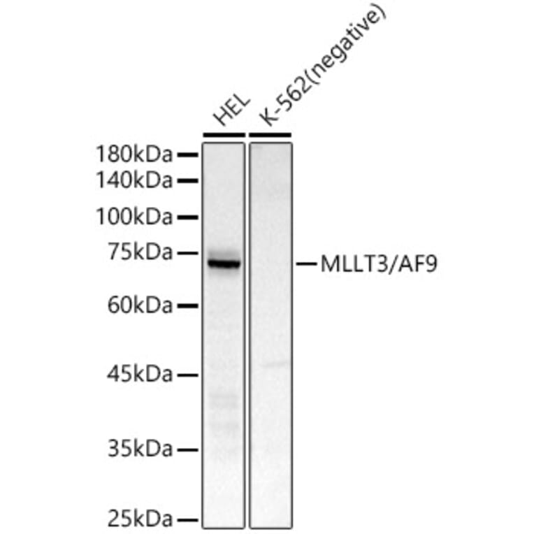 Western Blot - Anti-AF9 Antibody [ARC51958] (A307046) - Antibodies.com