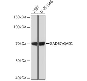 Western Blot - Anti-GAD67 Antibody [ARC1879] (A307047) - Antibodies.com