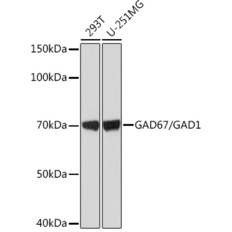 Western Blot - Anti-GAD67 Antibody [ARC1879] (A307047) - Antibodies.com