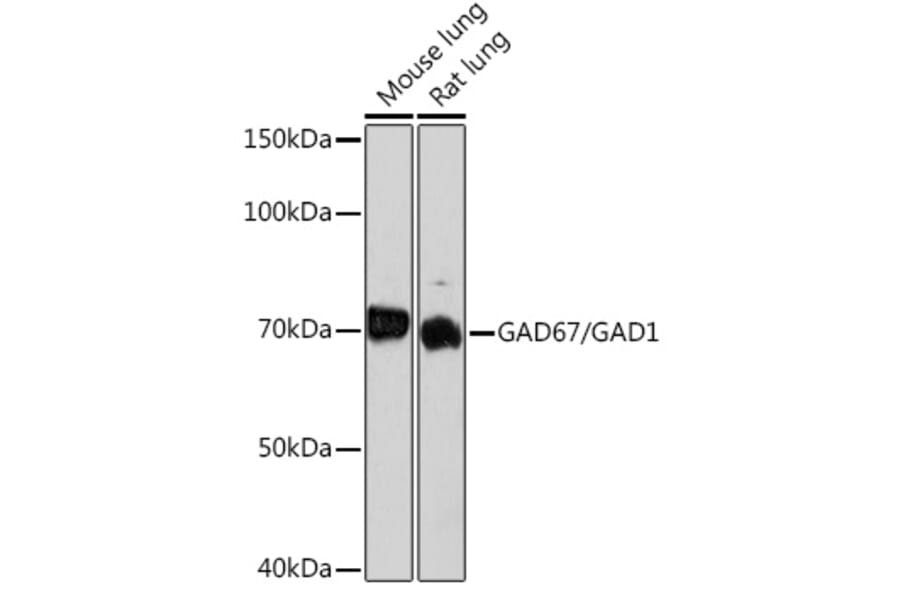 Western Blot - Anti-GAD67 Antibody [ARC1879] (A307047) - Antibodies.com