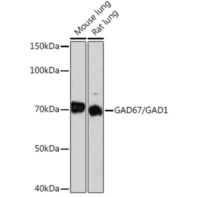 Western Blot - Anti-GAD67 Antibody [ARC1879] (A307047) - Antibodies.com