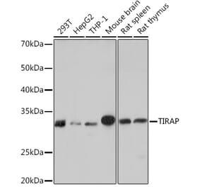 Western Blot - Anti-TIRAP Antibody [ARC1686] (A307048) - Antibodies.com