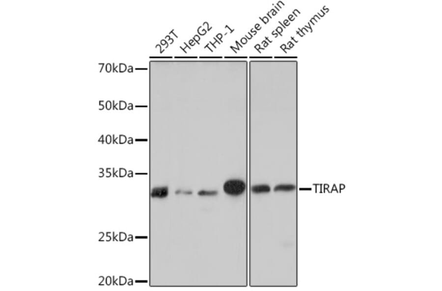 Western Blot - Anti-TIRAP Antibody [ARC1686] (A307048) - Antibodies.com