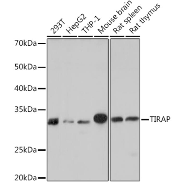 Western Blot - Anti-TIRAP Antibody [ARC1686] (A307048) - Antibodies.com