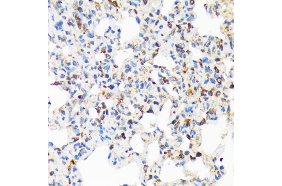 Immunohistochemistry - Anti-TIRAP Antibody [ARC1686] (A307048) - Antibodies.com