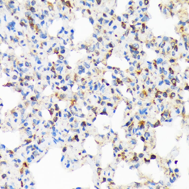 Immunohistochemistry - Anti-TIRAP Antibody [ARC1686] (A307048) - Antibodies.com
