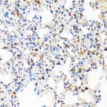 Immunohistochemistry - Anti-TIRAP Antibody [ARC1686] (A307048) - Antibodies.com