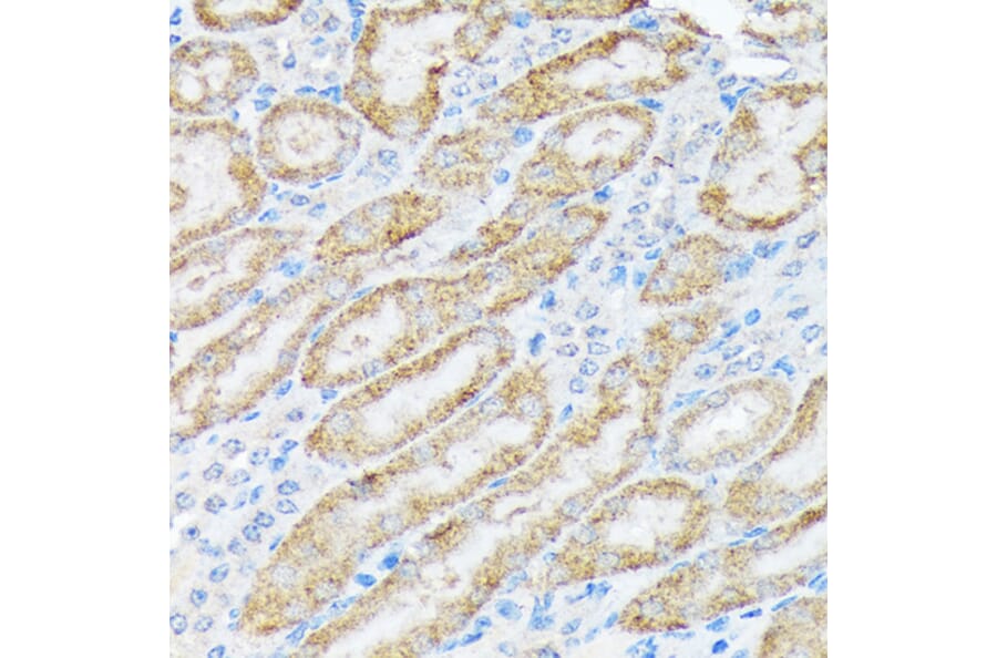 Immunohistochemistry - Anti-TIRAP Antibody [ARC1686] (A307048) - Antibodies.com