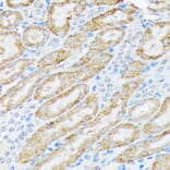 Immunohistochemistry - Anti-TIRAP Antibody [ARC1686] (A307048) - Antibodies.com