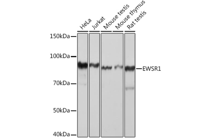 Western Blot - Anti-EWSR1/EWS Antibody [ARC1674] (A307049) - Antibodies.com