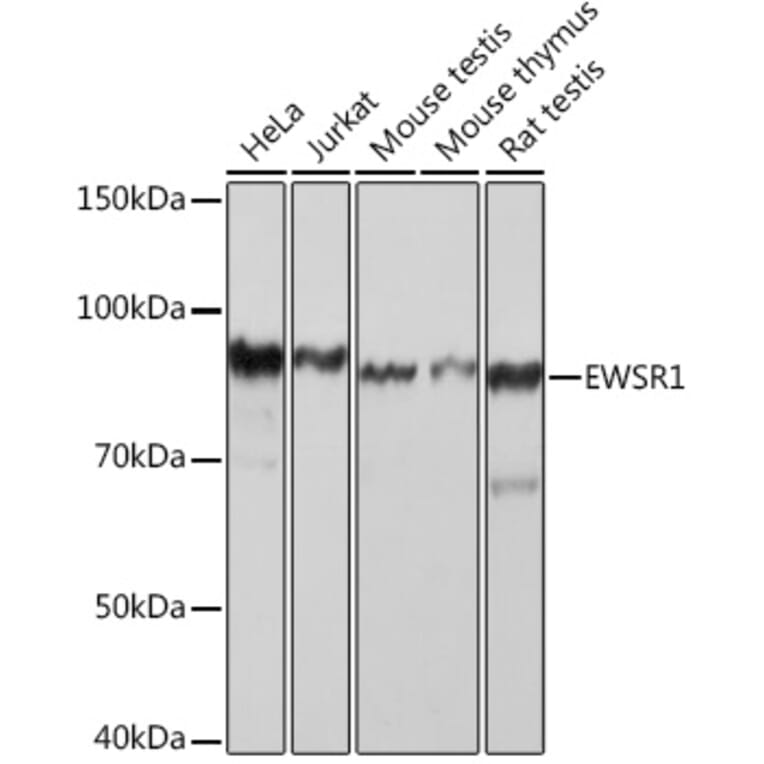 Western Blot - Anti-EWSR1/EWS Antibody [ARC1674] (A307049) - Antibodies.com