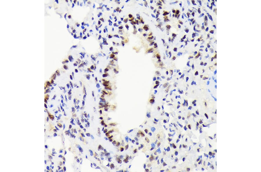 Immunohistochemistry - Anti-EWSR1/EWS Antibody [ARC1674] (A307049) - Antibodies.com