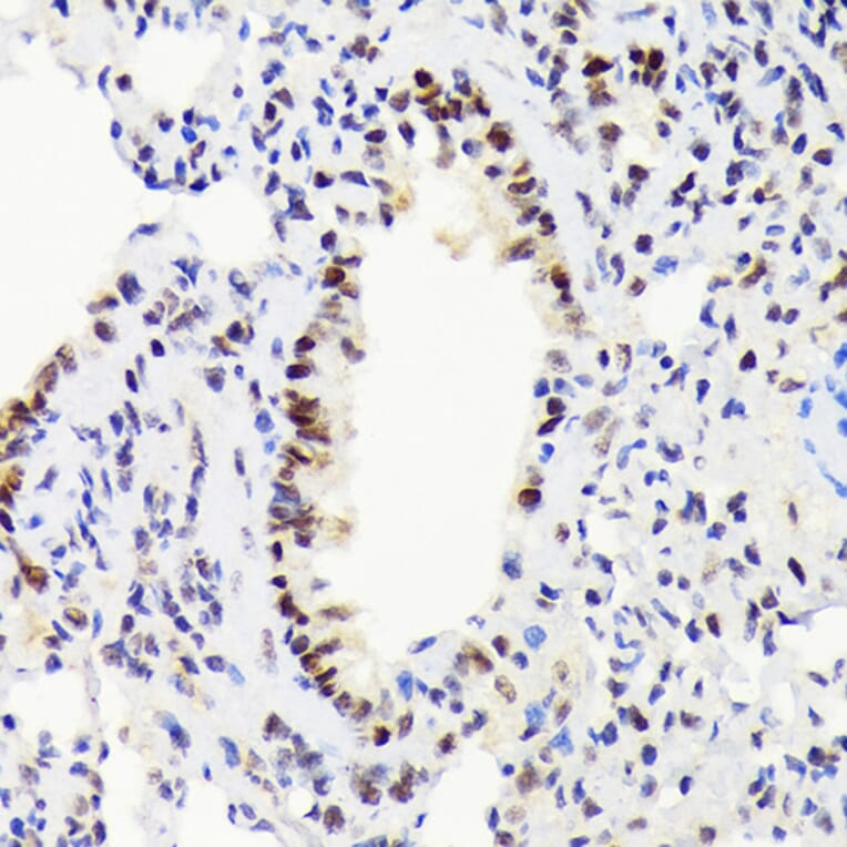 Immunohistochemistry - Anti-EWSR1/EWS Antibody [ARC1674] (A307049) - Antibodies.com