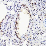 Immunohistochemistry - Anti-EWSR1/EWS Antibody [ARC1674] (A307049) - Antibodies.com