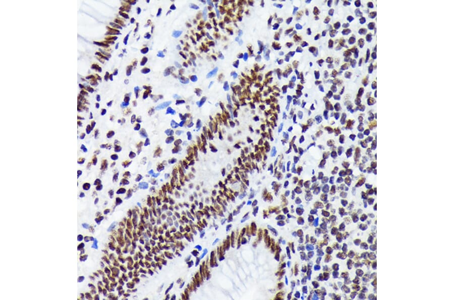 Immunohistochemistry - Anti-EWSR1/EWS Antibody [ARC1674] (A307049) - Antibodies.com
