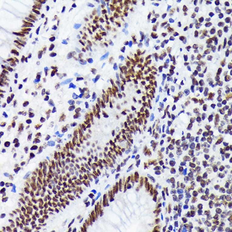 Immunohistochemistry - Anti-EWSR1/EWS Antibody [ARC1674] (A307049) - Antibodies.com