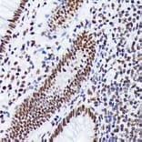 Immunohistochemistry - Anti-EWSR1/EWS Antibody [ARC1674] (A307049) - Antibodies.com