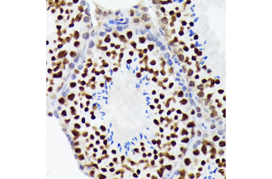 Immunohistochemistry - Anti-EWSR1/EWS Antibody [ARC1674] (A307049) - Antibodies.com