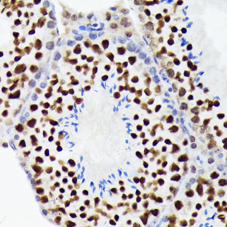 Immunohistochemistry - Anti-EWSR1/EWS Antibody [ARC1674] (A307049) - Antibodies.com