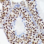 Immunohistochemistry - Anti-EWSR1/EWS Antibody [ARC1674] (A307049) - Antibodies.com