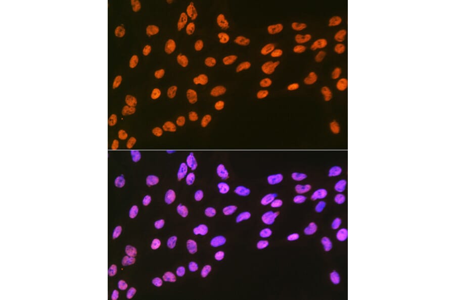 Immunofluorescence - Anti-EWSR1/EWS Antibody [ARC1674] (A307049) - Antibodies.com