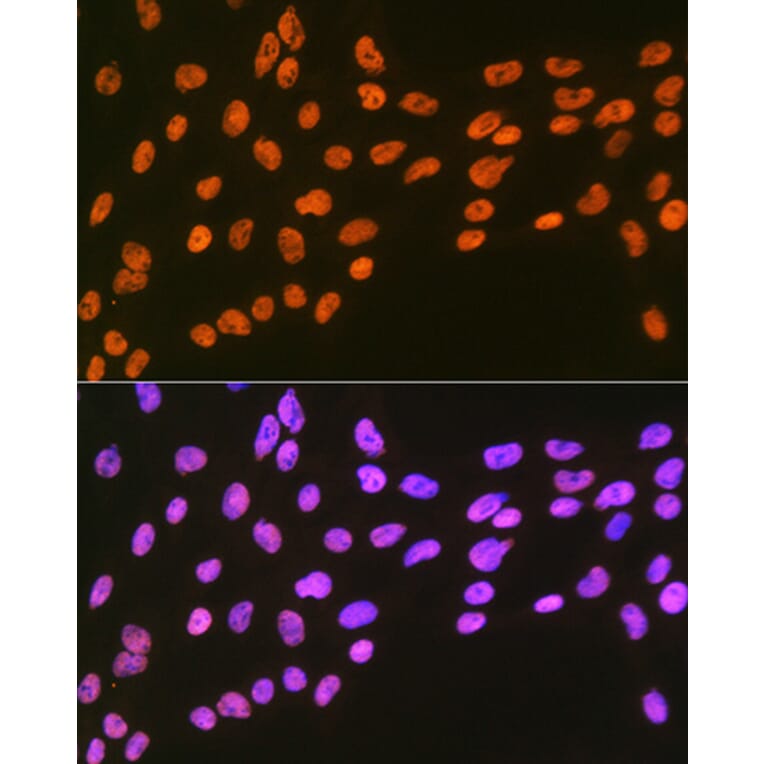 Immunofluorescence - Anti-EWSR1/EWS Antibody [ARC1674] (A307049) - Antibodies.com