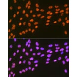 Immunofluorescence - Anti-EWSR1/EWS Antibody [ARC1674] (A307049) - Antibodies.com