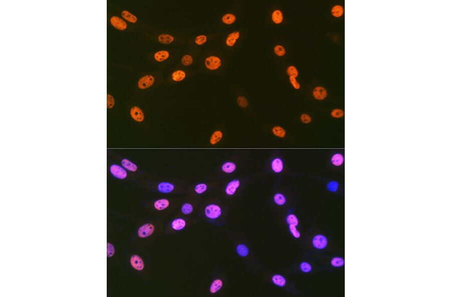 Immunofluorescence - Anti-EWSR1/EWS Antibody [ARC1674] (A307049) - Antibodies.com