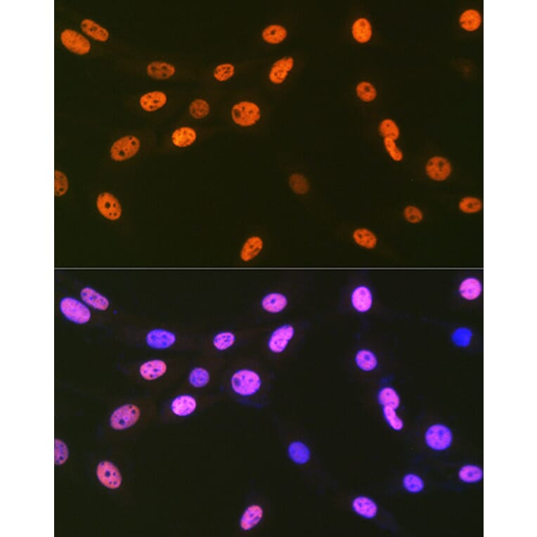 Immunofluorescence - Anti-EWSR1/EWS Antibody [ARC1674] (A307049) - Antibodies.com